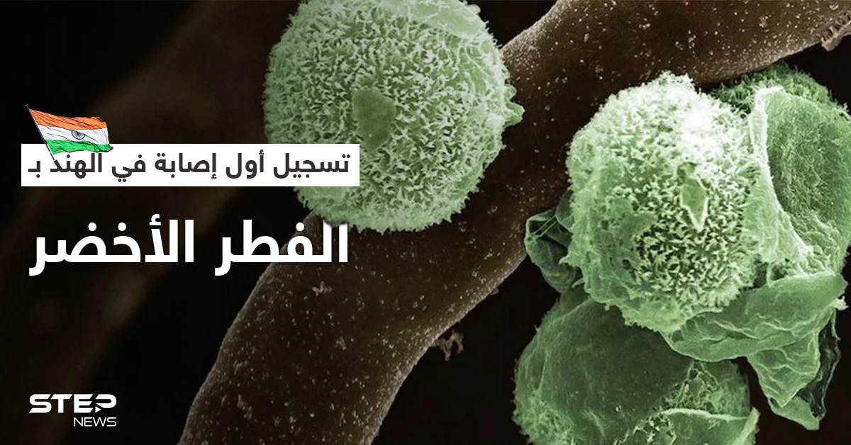 الهند تسجل أول إصابة بالفطر الأخضر في العالم.. وطبيب يشرح أعراضه