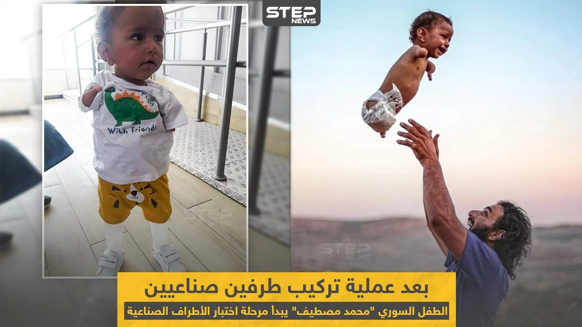 الطفل السوري "محمد مصطيف" بعد عملية تركيب طرفين صناعيين له