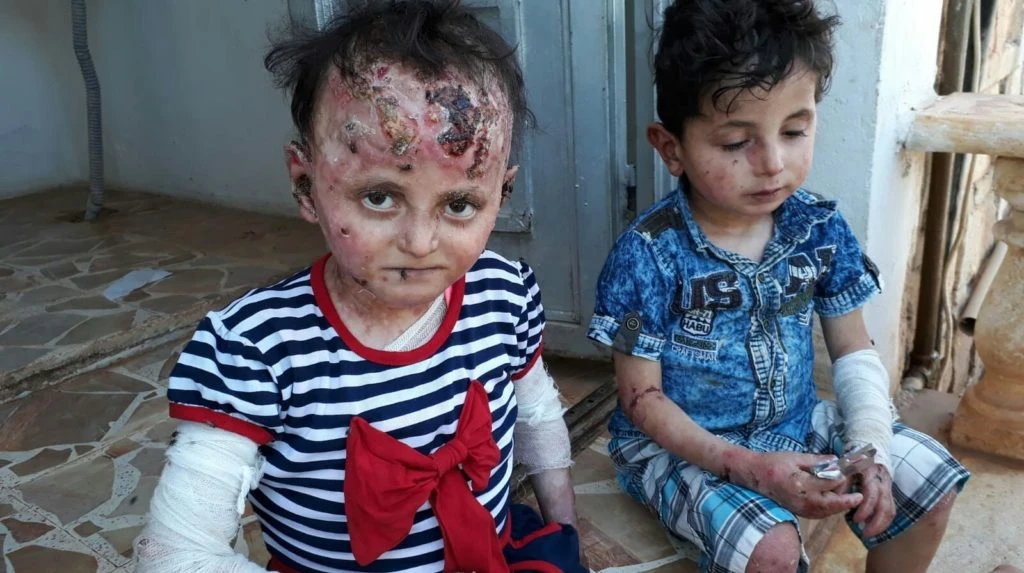 مرض نادر يفتك بطفلين شمالي حلب، ووالدهما يُناشد