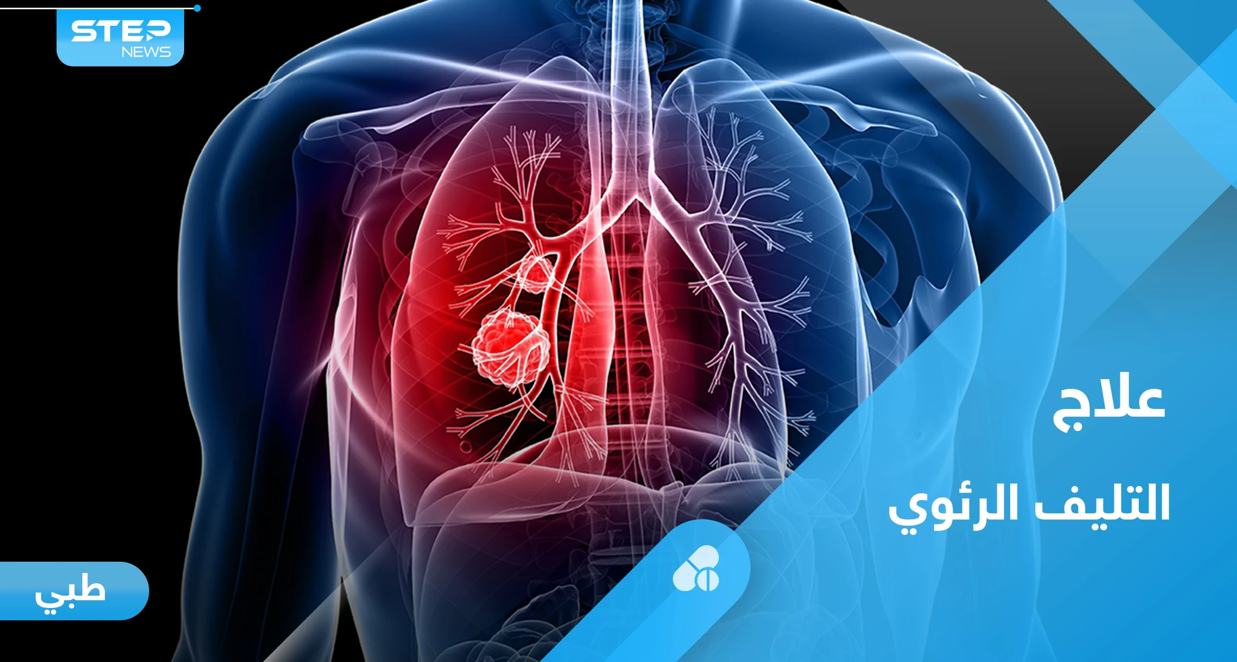 ما هو التليف الرئوي.. تعرف على أعراضه و أبرز طرق العلاج