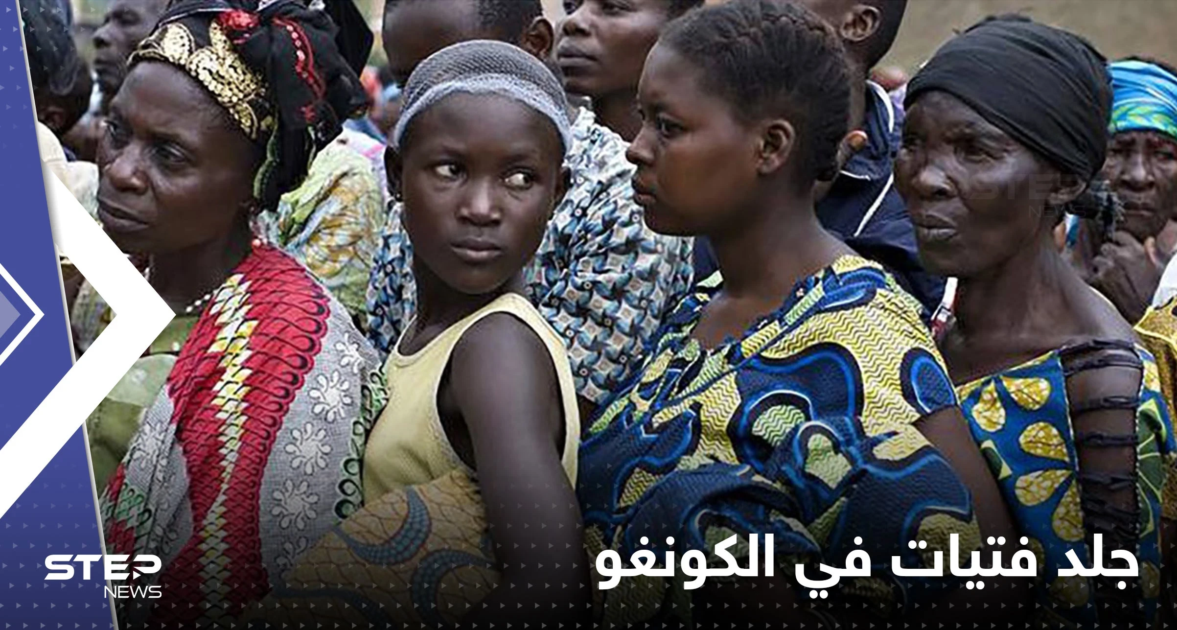 جلد فتيات ونساء في الكونغو بسبب ملابسهن القصيرة وارتدائهنّ السراويل