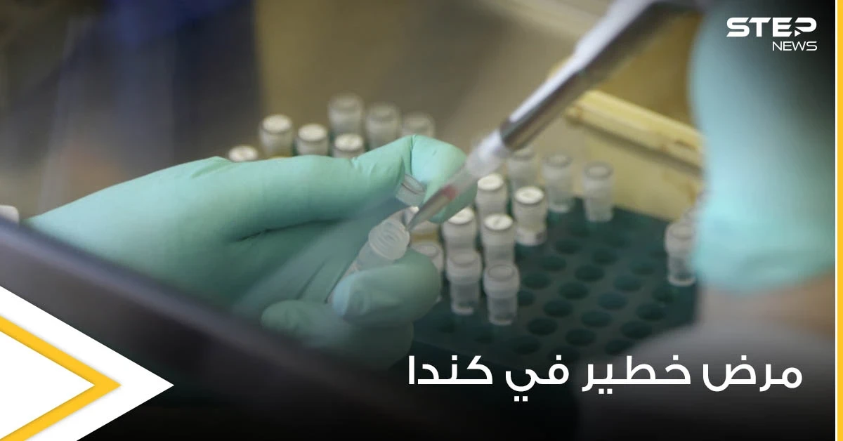 مرض مجهول ينتشر بكندا يحمل أعراضاً غريبة منها رؤية الموتى