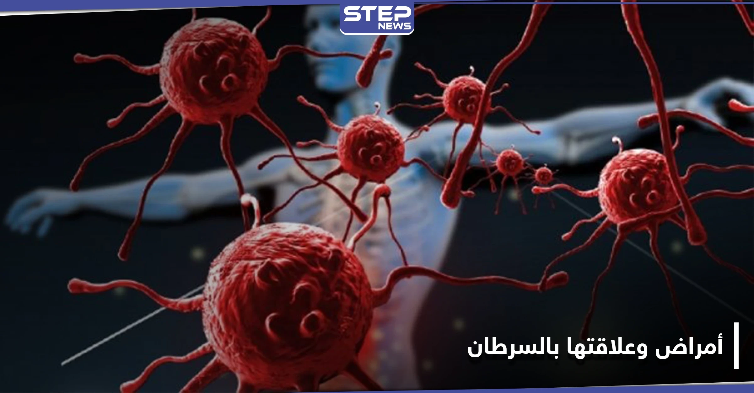 أمراض تسبب تطور السرطان ويمكن أن تسبب في نشأته.. فأحذرها وحاول معالجتها فوراً