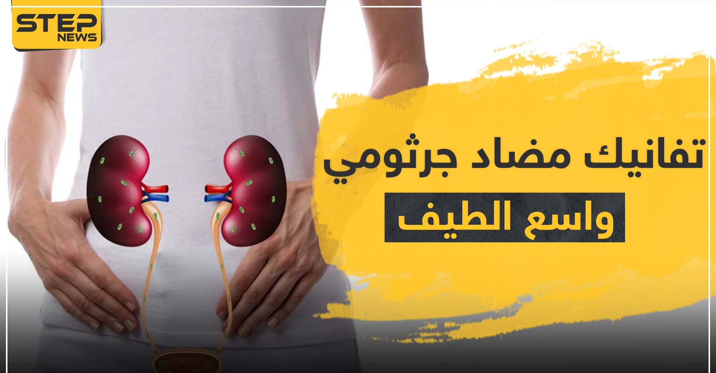 تفانيك tavanic مضاد جرثومي واسع الطيف