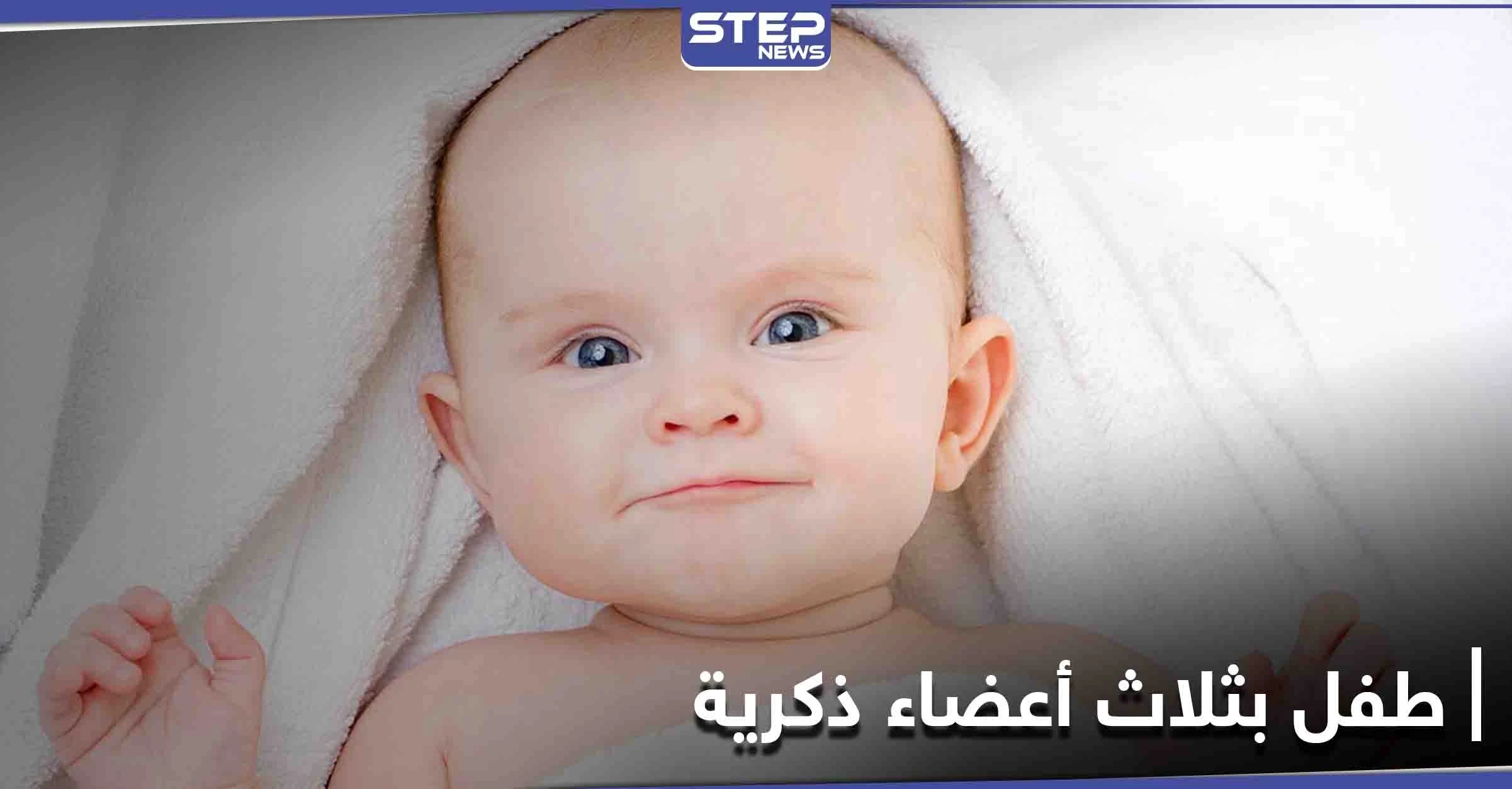 طفل عراقي بـ "3 أعضاء ذكريّة" كأول حالة مُسجلة في العالم