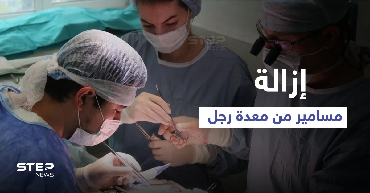 عملية جراحية معقدة لرجل ابتلع المسامير والبراغي لشهر كامل والسبب الكحول (صورة)