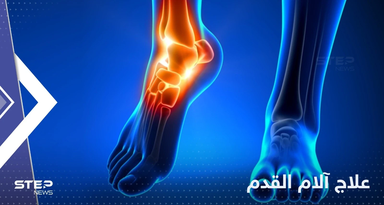 علاج آلام الأقدام من الوقوف.. تعرف على طرق منزلية بسيطة