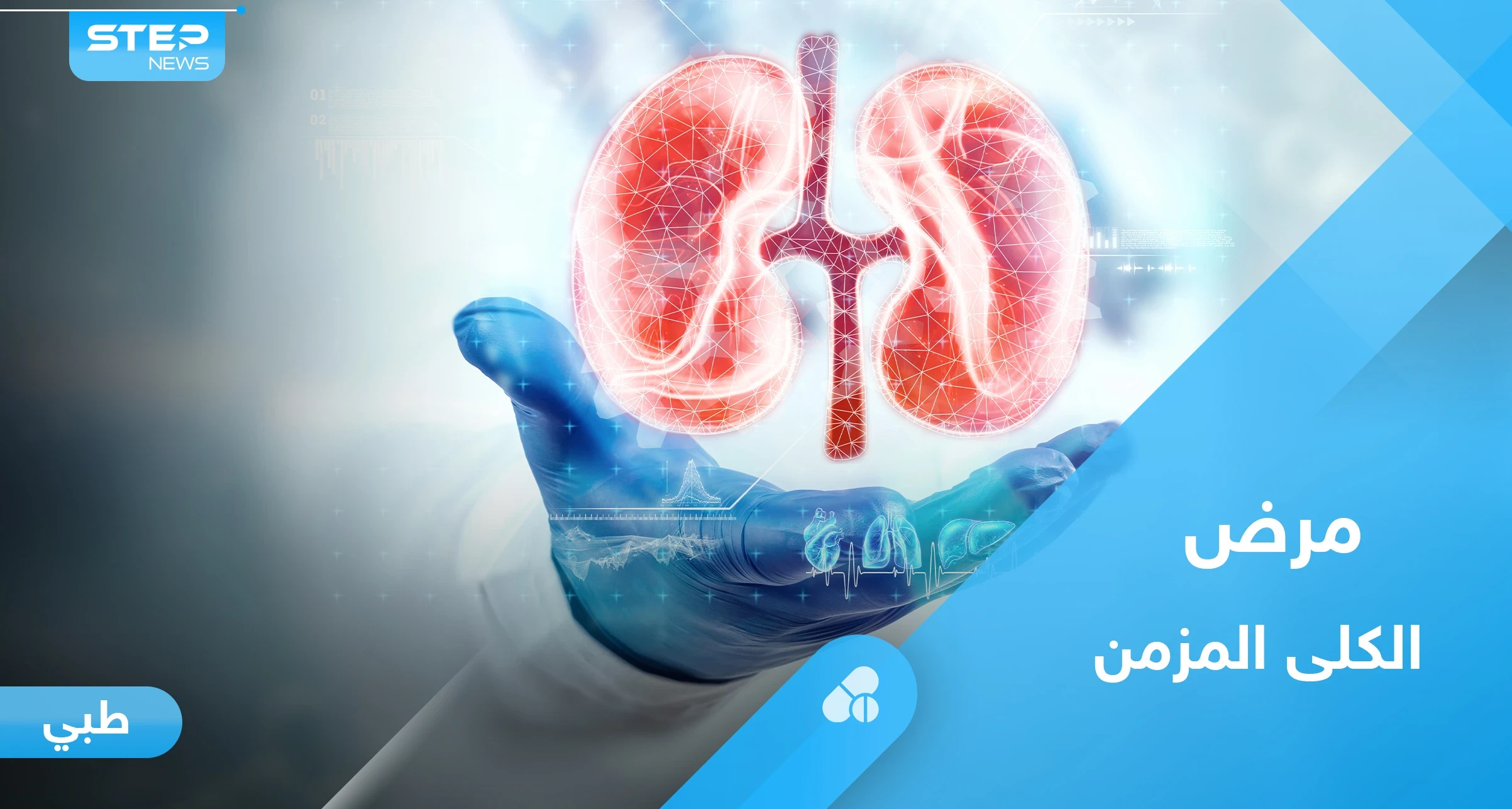 ما هو مرض الكلى المزمن.. إليك أهم المعلومات