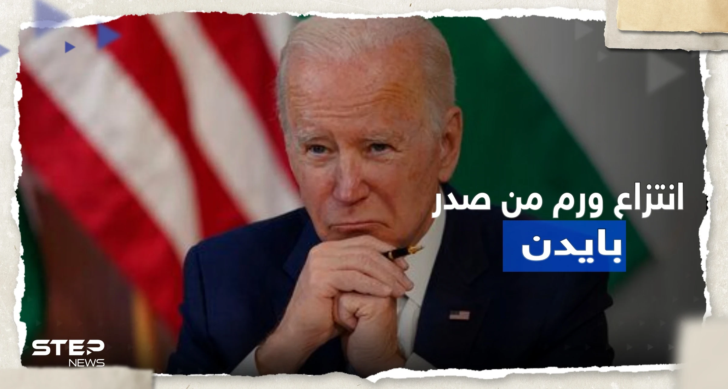 إزالة "ورم جلدي" من صدر بايدن وطبيبه يكشف 3 أمراض يعاني منها