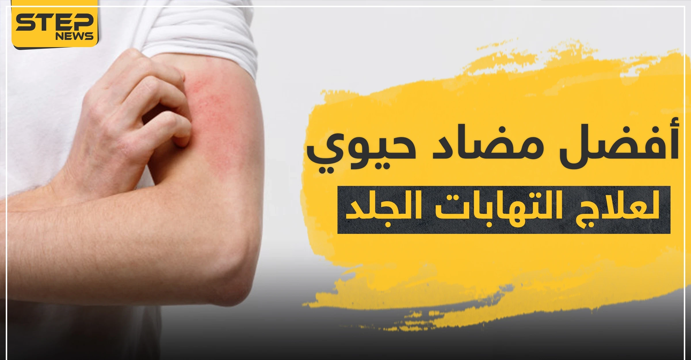 8 أسماء ... أفضل مضاد حيوي لعلاج التهابات الجلد