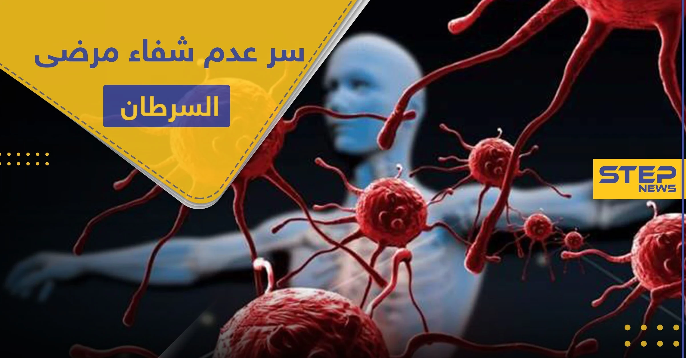 بحث أمريكي حديث.. يكشف خفايا مرض السرطان وسبب عدم امتثال المرضى للشفاء