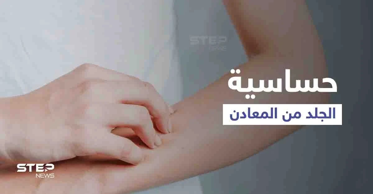 ما هي حساسية الجلد من المعادن وأهم أعراضها وطرق العلاج
