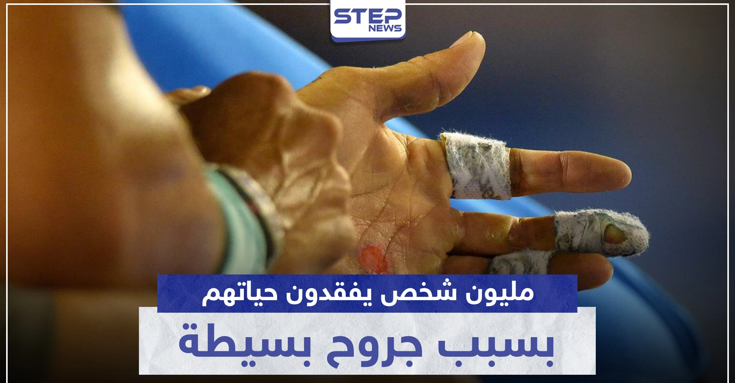 مليون شخص يفقدون حياتهم سنوياً بسبب جروح لا نعطيها أهمية.. تعرف ماذا تقول الدراسات