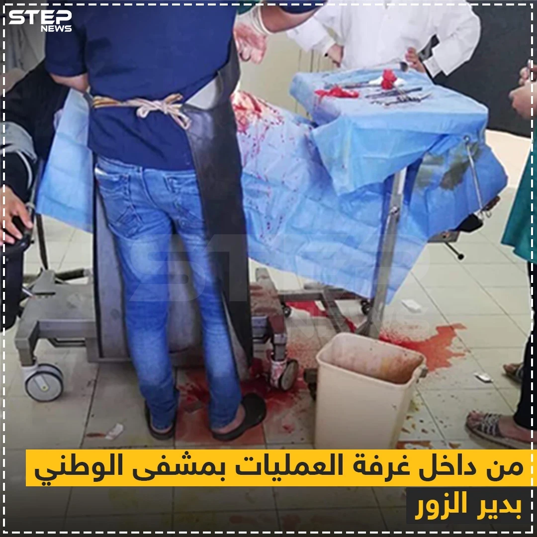 صورة متداولة من داخل غرفة العمليات بمشفى الوطني (النسائي) الملحق بمبنى مشفى الأسد الجامعي بدير الزور