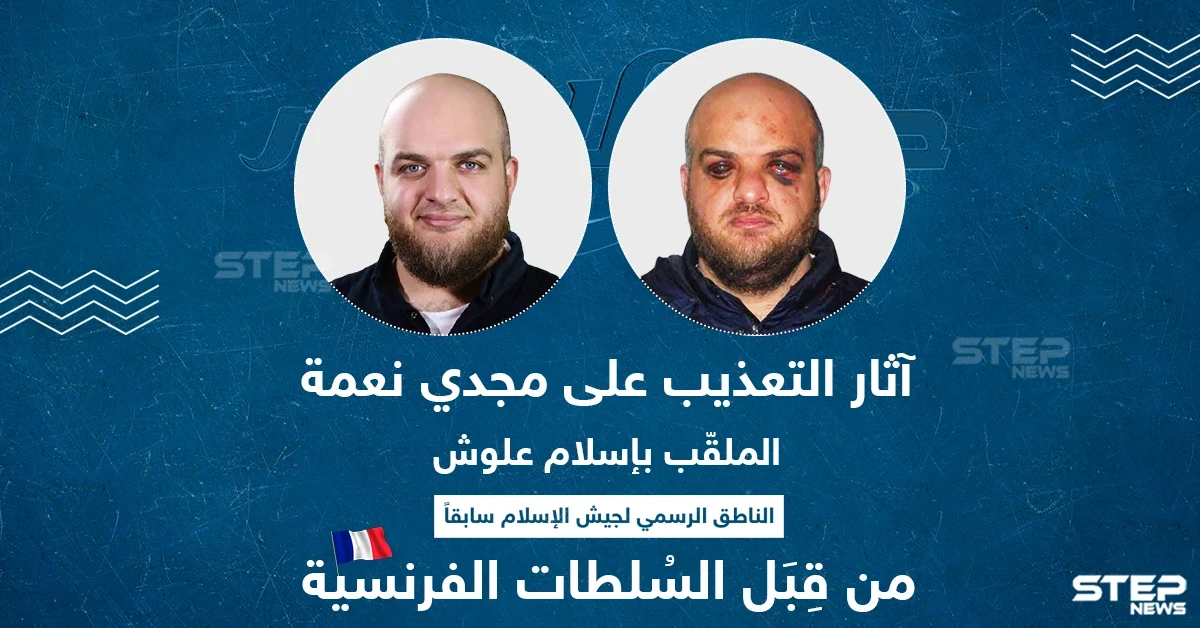 آثار التعذيب على مجدي نعمة الملقب بـ "إسلام علوش" من قبل السلطات الفرنسية