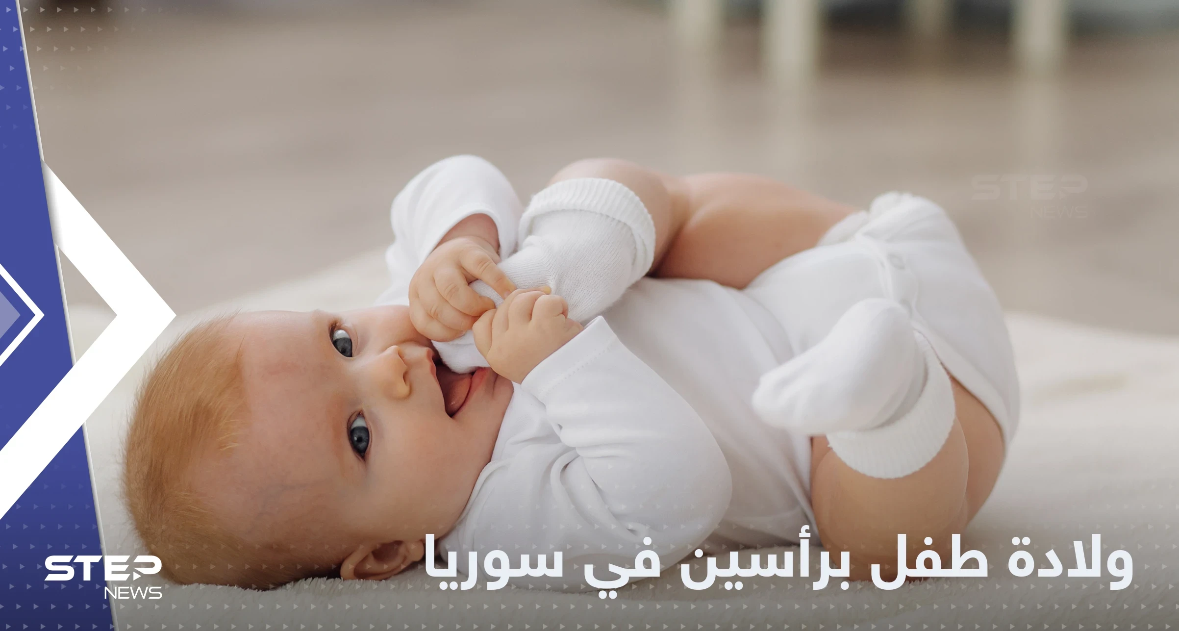 شاهد|| حالة طبية نادرة.. ولادة طفل برأسين في إدلب شمال سوريا