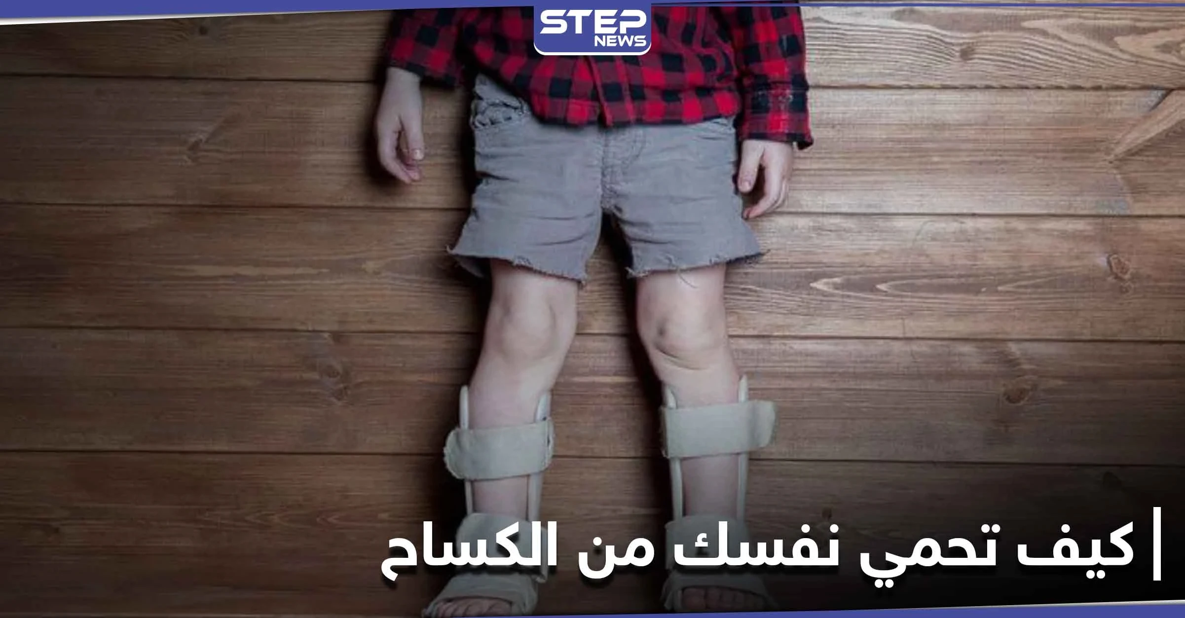 لين العظام.. كيف تحمي نفسك وأطفالك من خطر الإصابة بالكساح؟