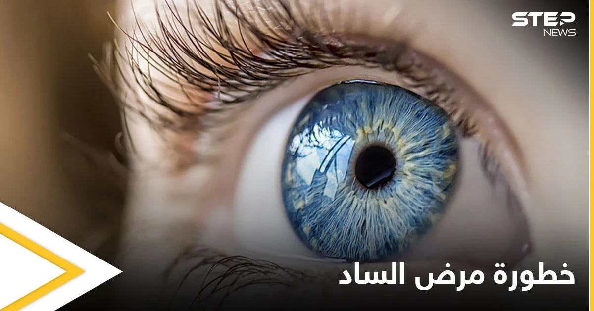 أكثر أمراض العين خبثاً.. ما هو مرض الساد وماهي أسبابه إليك التفاصيل