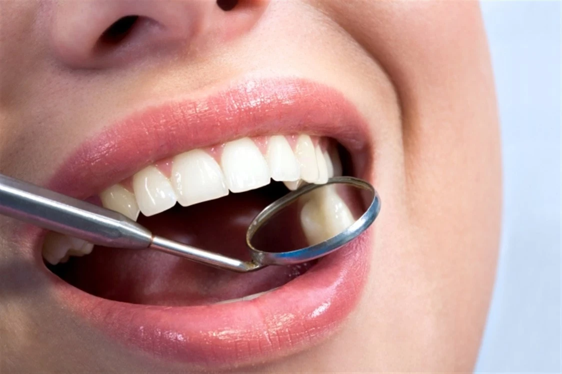 تجميل اللثة.. 4 أنواع رئيسي للعملية مع كافة التفاصيل والتكلفة والنصائح