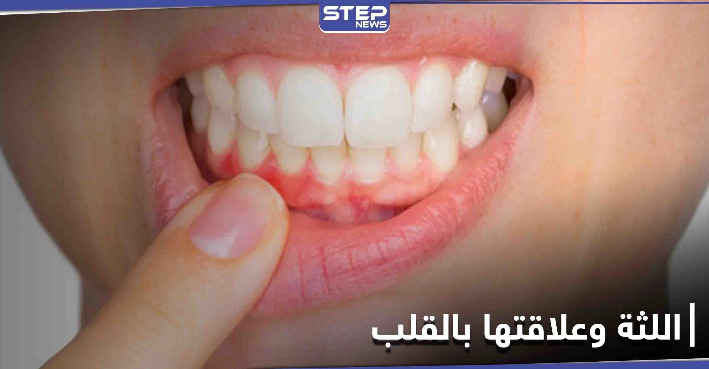 علامات تحذيرية غير معروفة موجودة في الفم قد تكشف أمراض القلب مبكراً
