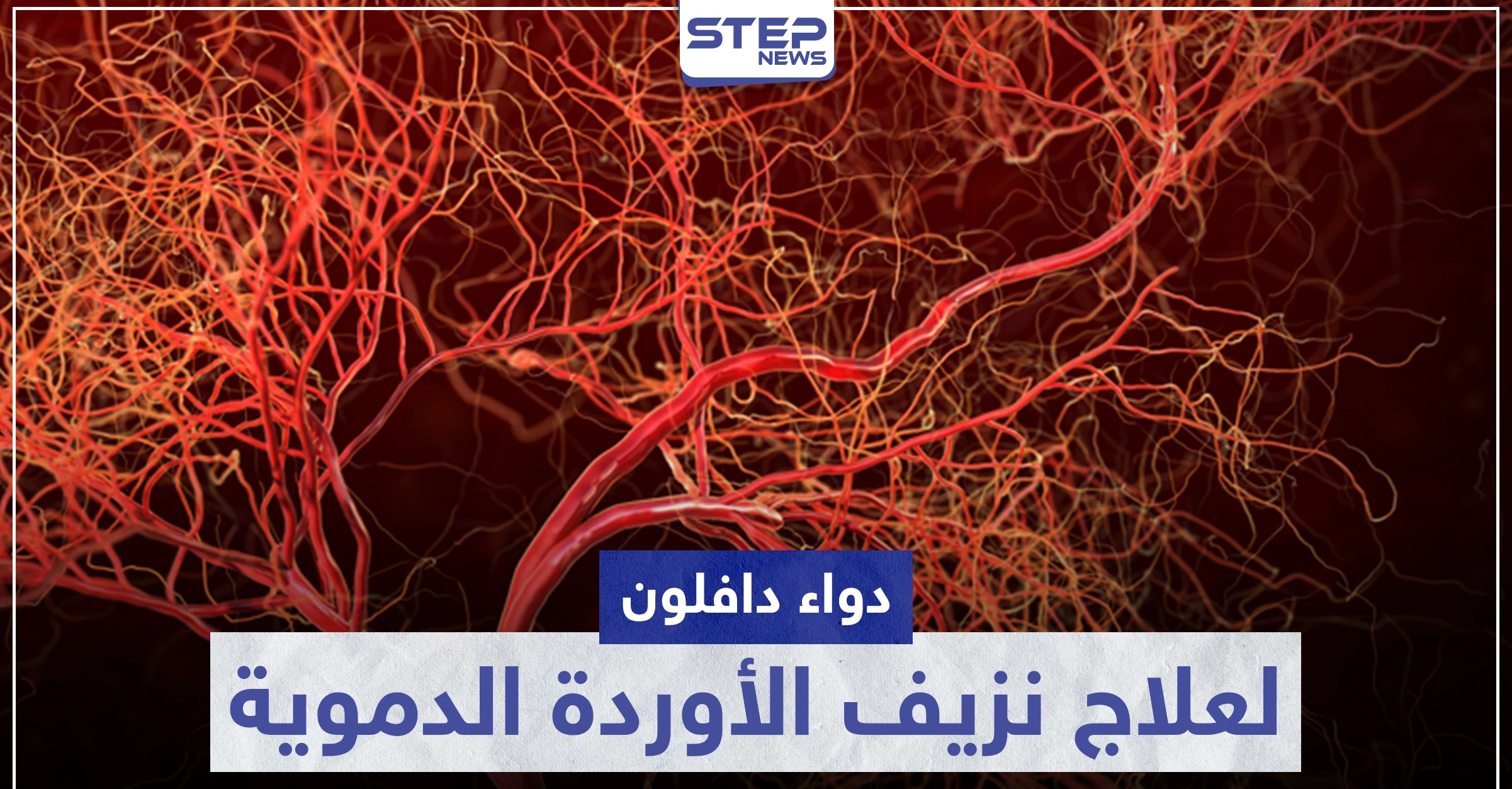 دواء دافلون Daflon لعلاج نزيف الأوردة الدموية