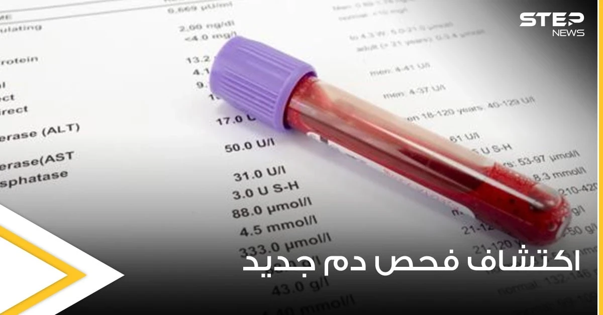في اختراق عملي مذهل.. التوصل لفحص دم بسيط يكشف 50 نوعاً من السرطان