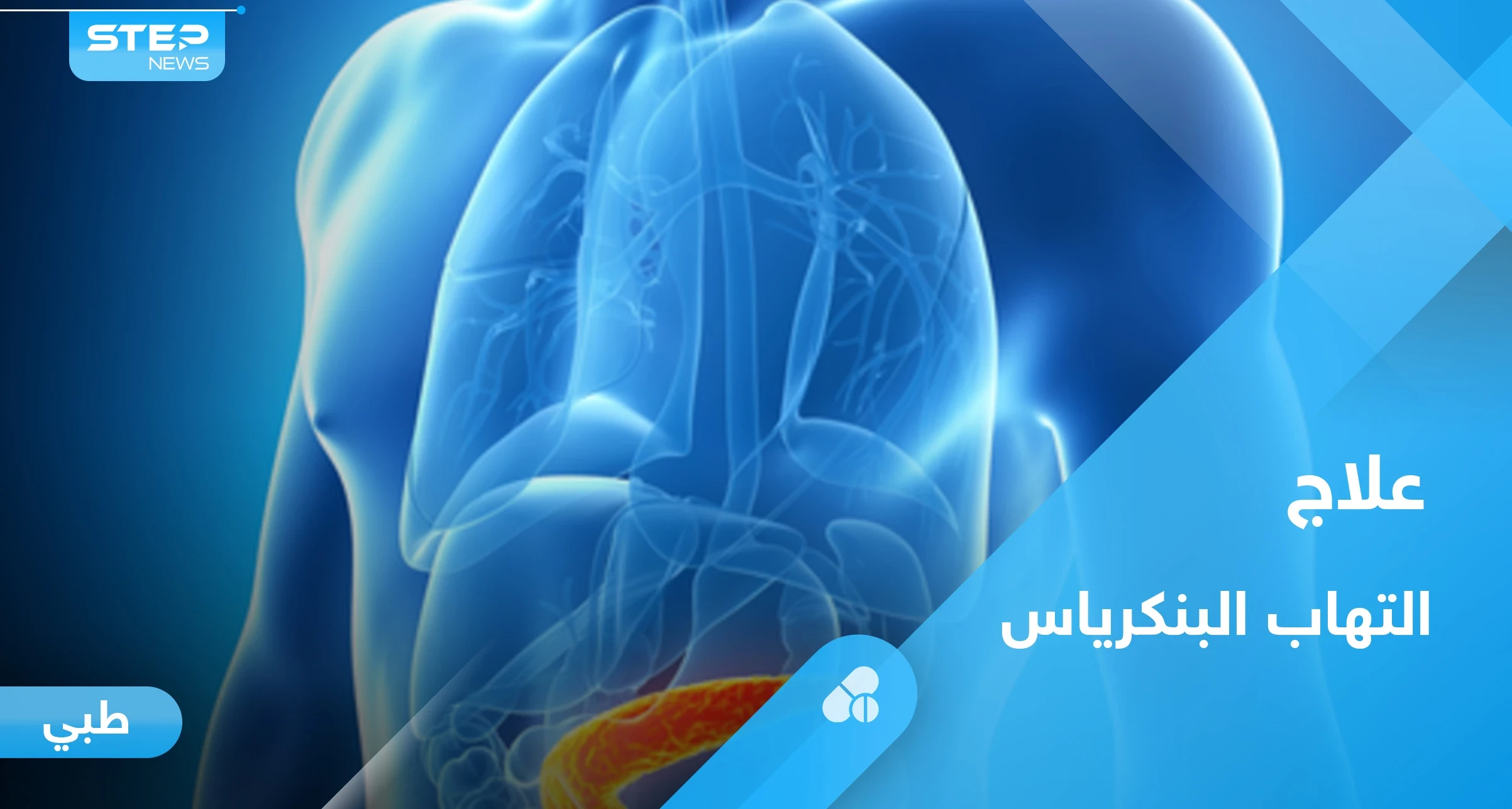 6 أسباب لالتهاب البنكرياس الحاد عليك معرفتها وأهم طرق العلاج