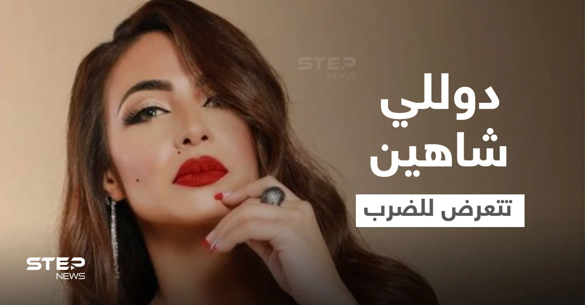 دوللي شاهين تتعرض للضرب المبرح وتنشر صور الكدمات التي ظهرت على وجهها وجسدها ومدير أعمالها يوضح (صور)