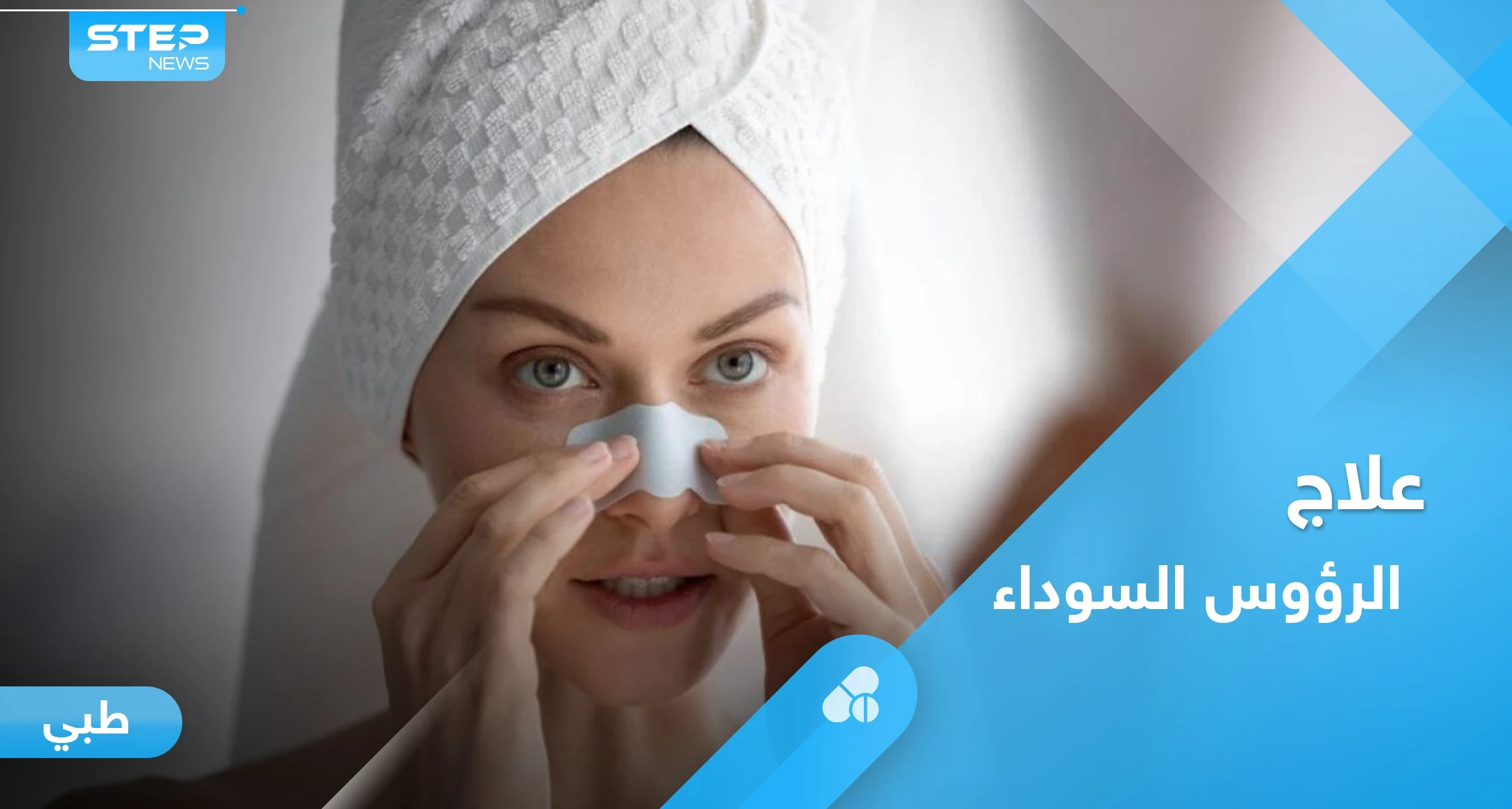 الرؤوس السوداء.. أسباب ظهورها والأنواع وطرق العلاج